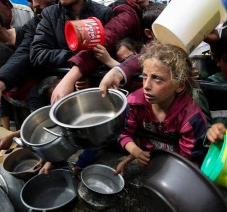 حصار غزة..  وفاة 76 طفلا جراء الجوع وسوء التغذية