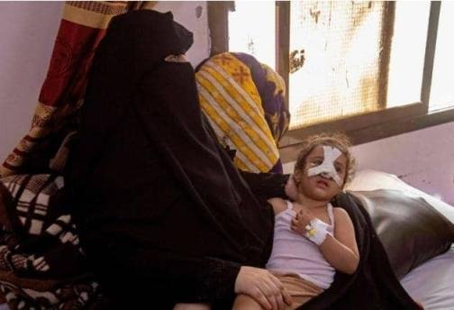 فقدان الرعاية الطبية يهدد حياة الأطفال والأمهات في اليمن..!