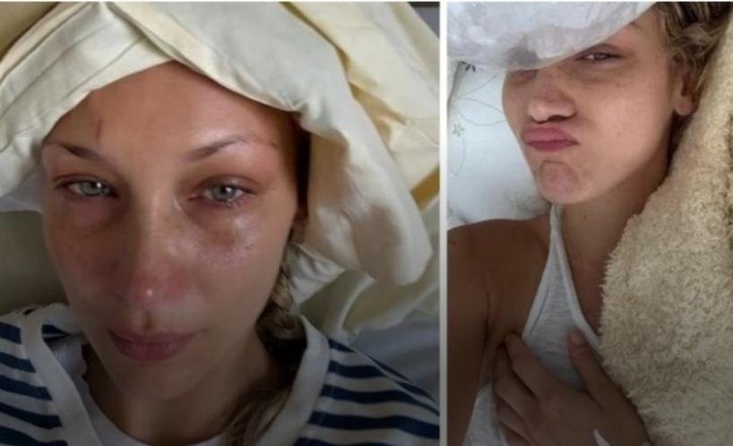 بيلا حديد تكشف معاناتها مع مرض "لايم"