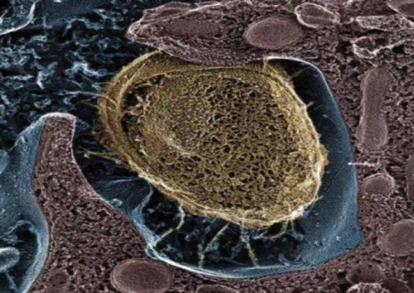 أبرز أعراض التهاب المسالك البولية