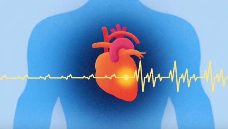 الرجفان الأذيني.. ماأسبابه وطرق علاجة