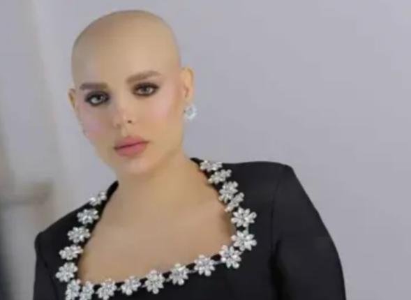 كشفت معاناتها مع علاج السرطان.. هبة السيسي: شعرت بالصدمة من بعض الأصدقاء