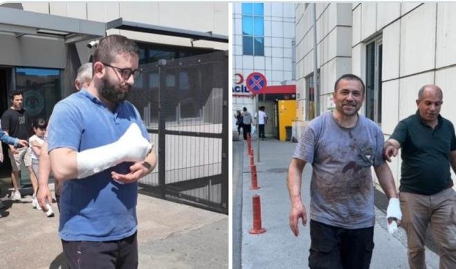 13ألف مصاب خلال حوادث ذبح الأضاحي في تركيا