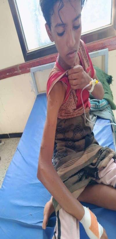 قناص حوثي يستهدف طفلاً في منطقة كرش الحدودية شمال لحج