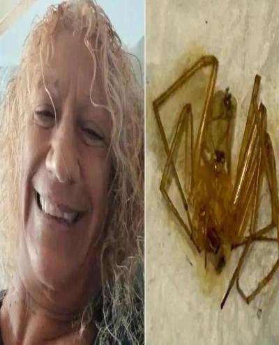 امرأة تقاضي مجمع شقق في فلوريدا بسبب لدغات العناكب