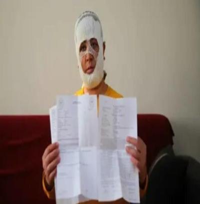 جميلة تركية تخسر وجهها بسبب عملية تجميل فاشلة